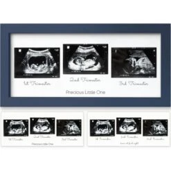 KeaBabies Trio Baby Sonogram Picture Frame, Baby Ultrasound Picture Frames For Baby Nursery, Mom To Be Gifts 23 KeaBabies Trio Baby Sonogram Picture Frame, Baby Ultrasound Picture Frames For Baby Nursery, Mom To Be Gifts -Home Decor Shop GUEST 0d39649d 6126 4bba b217 1b917313aa7c