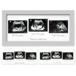 KeaBabies Trio Baby Sonogram Picture Frame, Baby Ultrasound Picture Frames For Baby Nursery, Mom To Be Gifts 22 KeaBabies Trio Baby Sonogram Picture Frame, Baby Ultrasound Picture Frames For Baby Nursery, Mom To Be Gifts -Home Decor Shop GUEST 3bf25d41 c634 498c 84e3 c83dfec65ad0