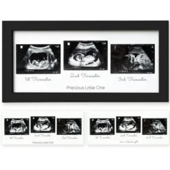 KeaBabies Trio Baby Sonogram Picture Frame, Baby Ultrasound Picture Frames For Baby Nursery, Mom To Be Gifts 21 KeaBabies Trio Baby Sonogram Picture Frame, Baby Ultrasound Picture Frames For Baby Nursery, Mom To Be Gifts -Home Decor Shop GUEST 692bd1b8 56a8 4616 9d57 d9c4204c1c6d