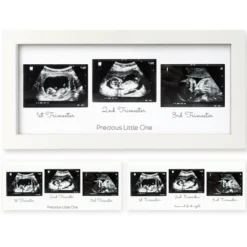 KeaBabies Trio Baby Sonogram Picture Frame, Baby Ultrasound Picture Frames For Baby Nursery, Mom To Be Gifts 20 KeaBabies Trio Baby Sonogram Picture Frame, Baby Ultrasound Picture Frames For Baby Nursery, Mom To Be Gifts -Home Decor Shop GUEST c8d682a4 195b 4175 a0a5 f4e027afd6f2