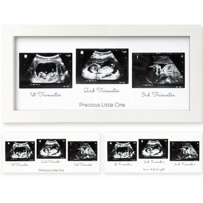 KeaBabies Trio Baby Sonogram Picture Frame, Baby Ultrasound Picture Frames For Baby Nursery, Mom To Be Gifts 10 KeaBabies Trio Baby Sonogram Picture Frame, Baby Ultrasound Picture Frames For Baby Nursery, Mom To Be Gifts - Image 8